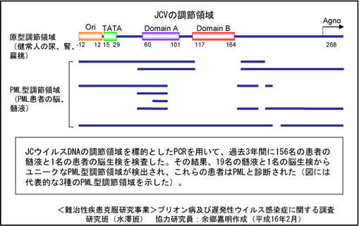 JCウイルス調節領域の再編成を利用した進行性多巣性白質脳症 のPCR診断